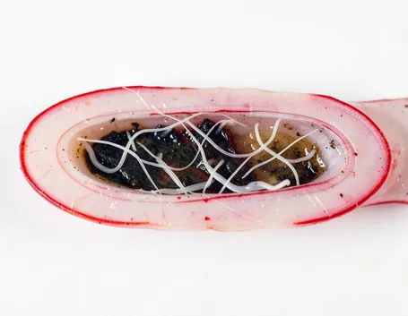 vermi intestinali