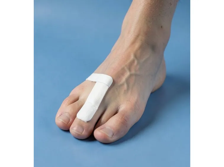 Alluce valgo